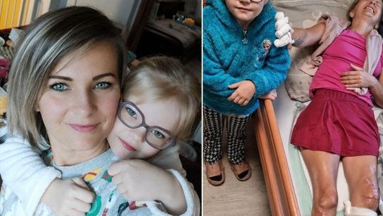 Wypadek zmienił jej życie. Mieszkanka gminy Prażmów potrzebuje naszej pomocy
