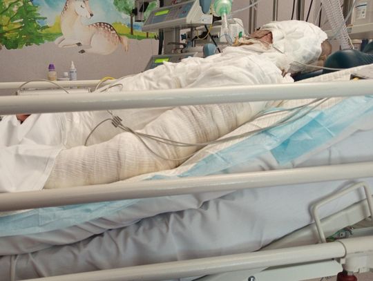 Trzynastoletni Marcel z Piaseczna walczy o życie po porażeniu prądem