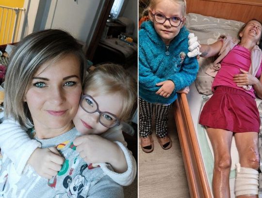 Wypadek zmienił jej życie. Mieszkanka gminy Prażmów potrzebuje naszej pomocy