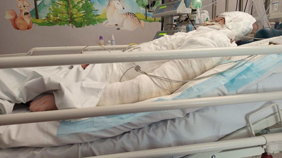 Trzynastoletni Marcel z Piaseczna walczy o życie po porażeniu prądem