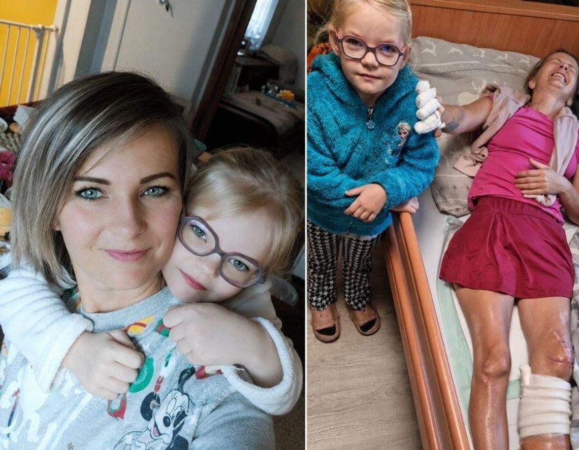 Wypadek zmienił jej życie. Mieszkanka gminy Prażmów potrzebuje naszej pomocy